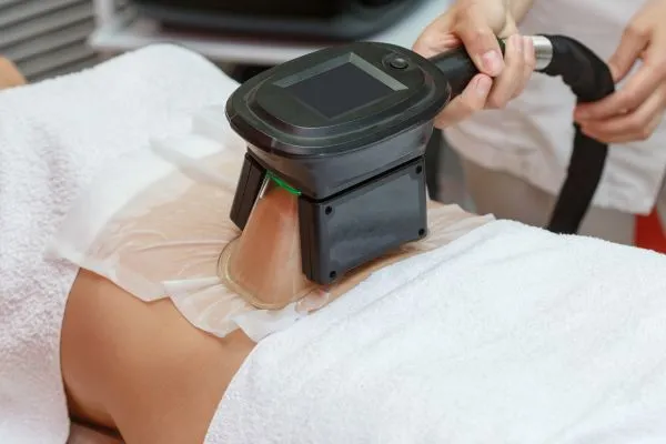 Image of person having fat freezing treatment to help weight gain Hertford