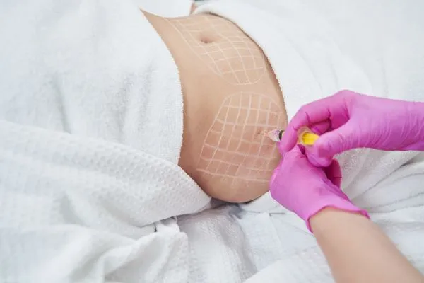 image of fat dissolving injections on love handles to help combat weight gain Hertford
