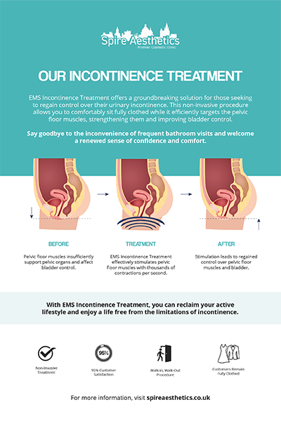 image to show how EMS treatment works for female urinary incontinence Hertford