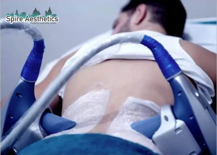 Man having fat freezing treatment done on love handles before a competitions Hertford to create a sculpted look.