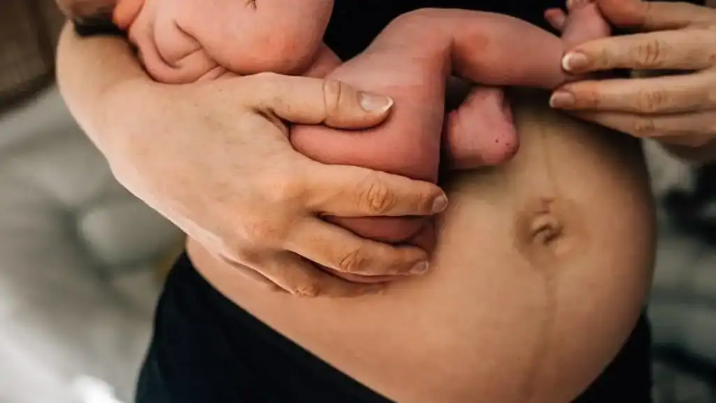 Why Is My Stomach Still Big After Pregnancy Hertford?
